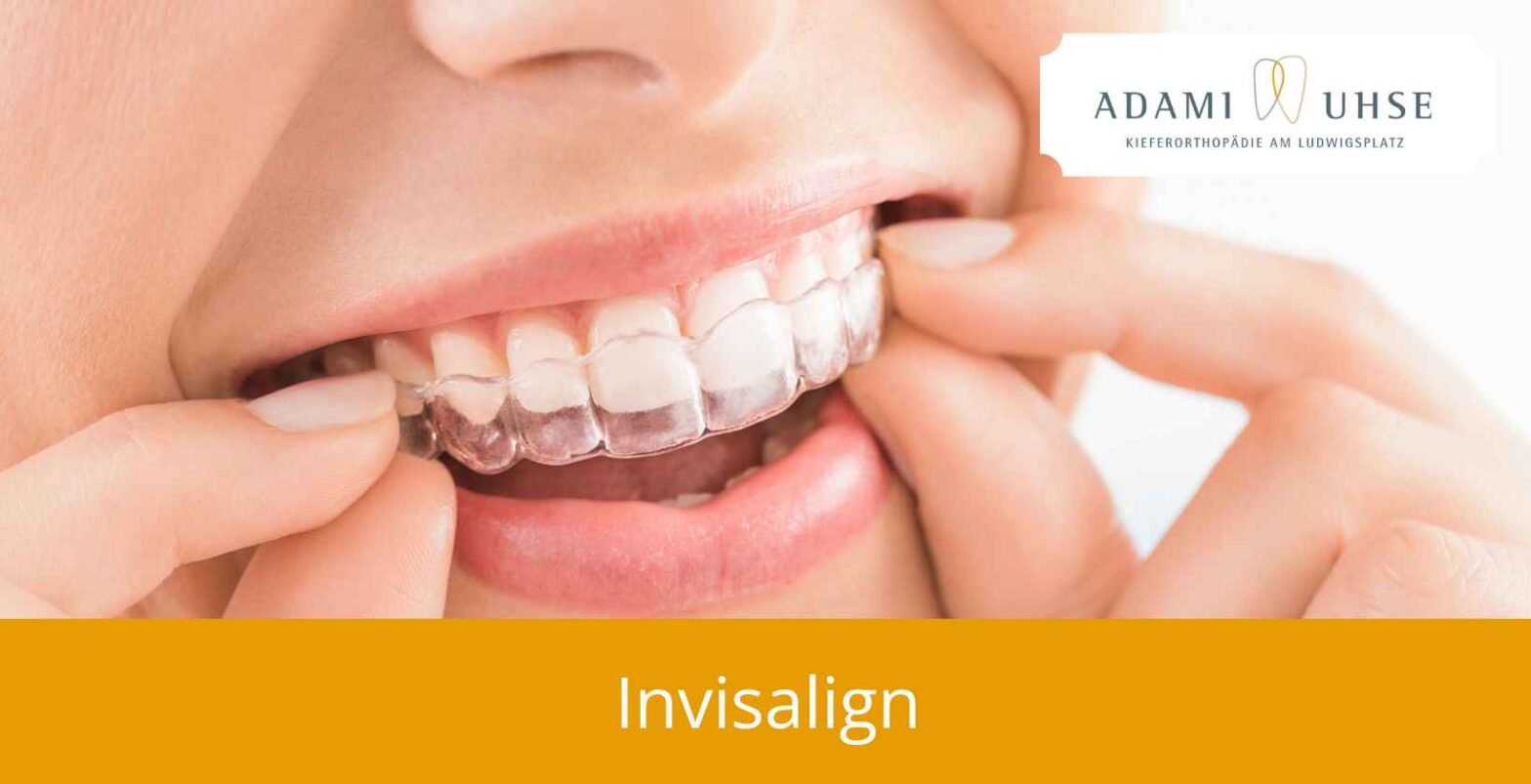 Invisalign Darmstadt